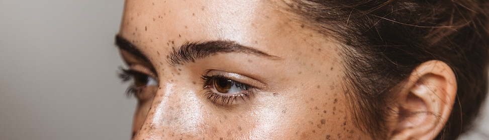 Young Woman with Freckles