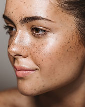 Young Woman with Freckles