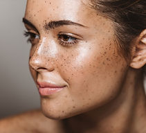 Young Woman with Freckles