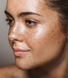 Freckled Woman Portrait