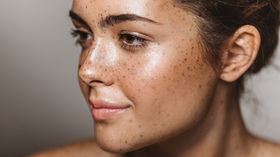 Comment ralentir les taches brunes sur la peau avec Forever EPIBLANC ?