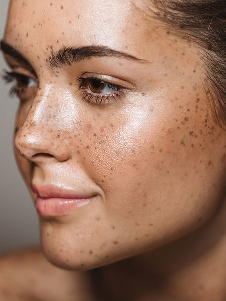 Young Woman with Freckles
