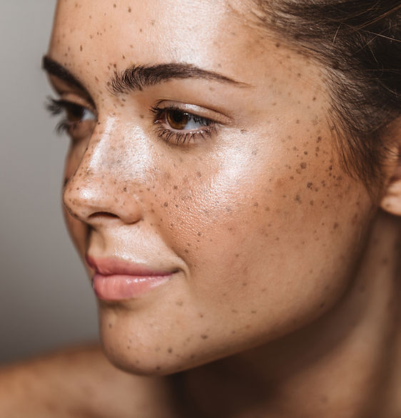 glowing skin, cheek filler, facial balancing