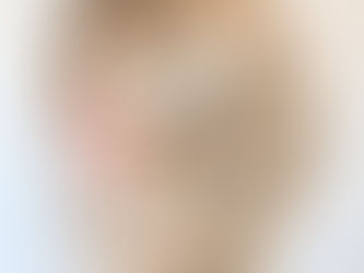 What Is a Custom Hair System and How Does It Work?