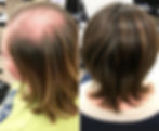 PP405 vs. Traditional Hair Loss Solutions: How Does It Compare?