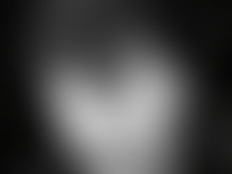 How do I know if my hair loss is temporary or permanent?