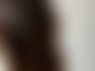 Does dry shampoo cause hair loss?