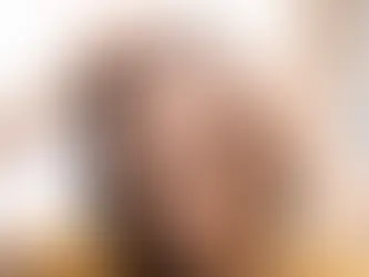Will an Itchy Scalp Cause Hair Loss?