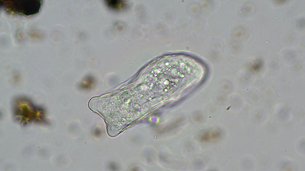 forest soil creatures20250912125746946