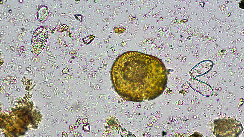Emily June 15 2024_diversity and ciliates_1in1020240615125654808_edited