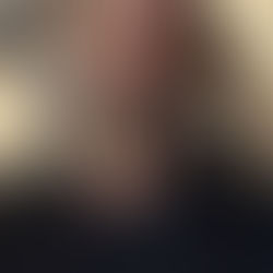 O dia da cirurgia de catarata pode gerar ansiedade, mas é importante saber: 