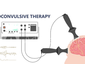 Electroconvulsive therapy (ECT)- 