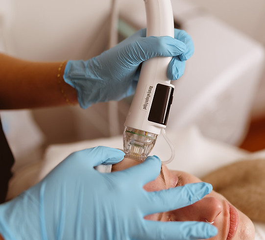 Dermaforce RF (1).JPG