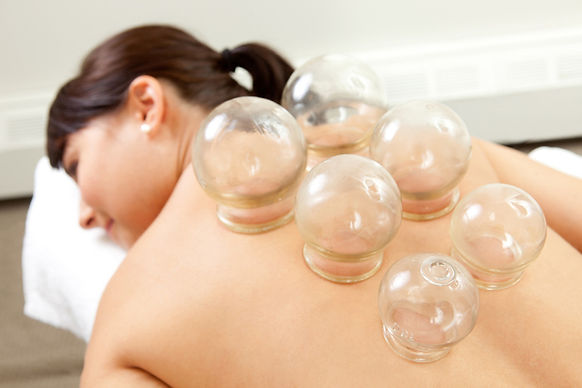 cupping little rock arkansas.jpg