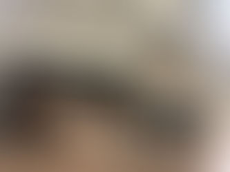 Is your scalp dehydrated?