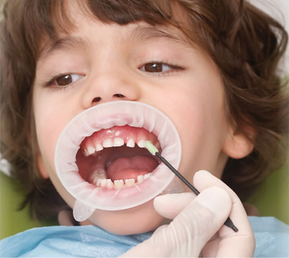 01_Fluoride application.jpg