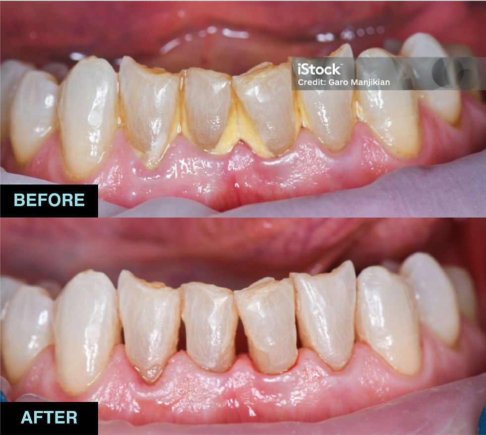 01_Cleaning & Polishing.jpg