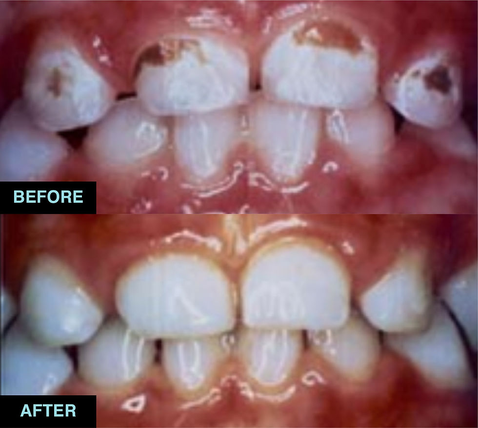 11_Fillings and root canal treatment.jpg