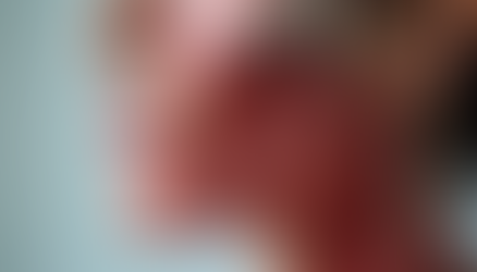 How Muscle Tightening Contributes to Facial Aging and the Preventative Role of Neurotoxins