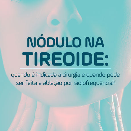 Câncer de tireoide: quando é indicada a cirurgia e quando pode ser feita a ablação por radiofrequência?