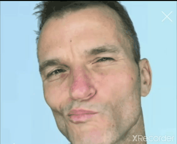 Full Cheek Lift Exercise