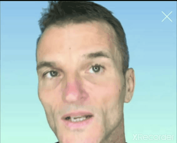 Middle Cheek Lift Handsfree