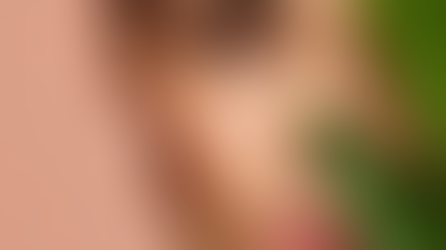 How to Treat Pigmentation: Expert Tips for Radiant Skin