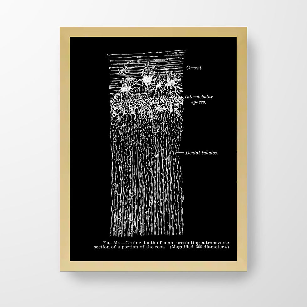 Thumbnail: Dental Roots Orthodontic Oral Surgery X-Ray Black Human Anatomy Art Print