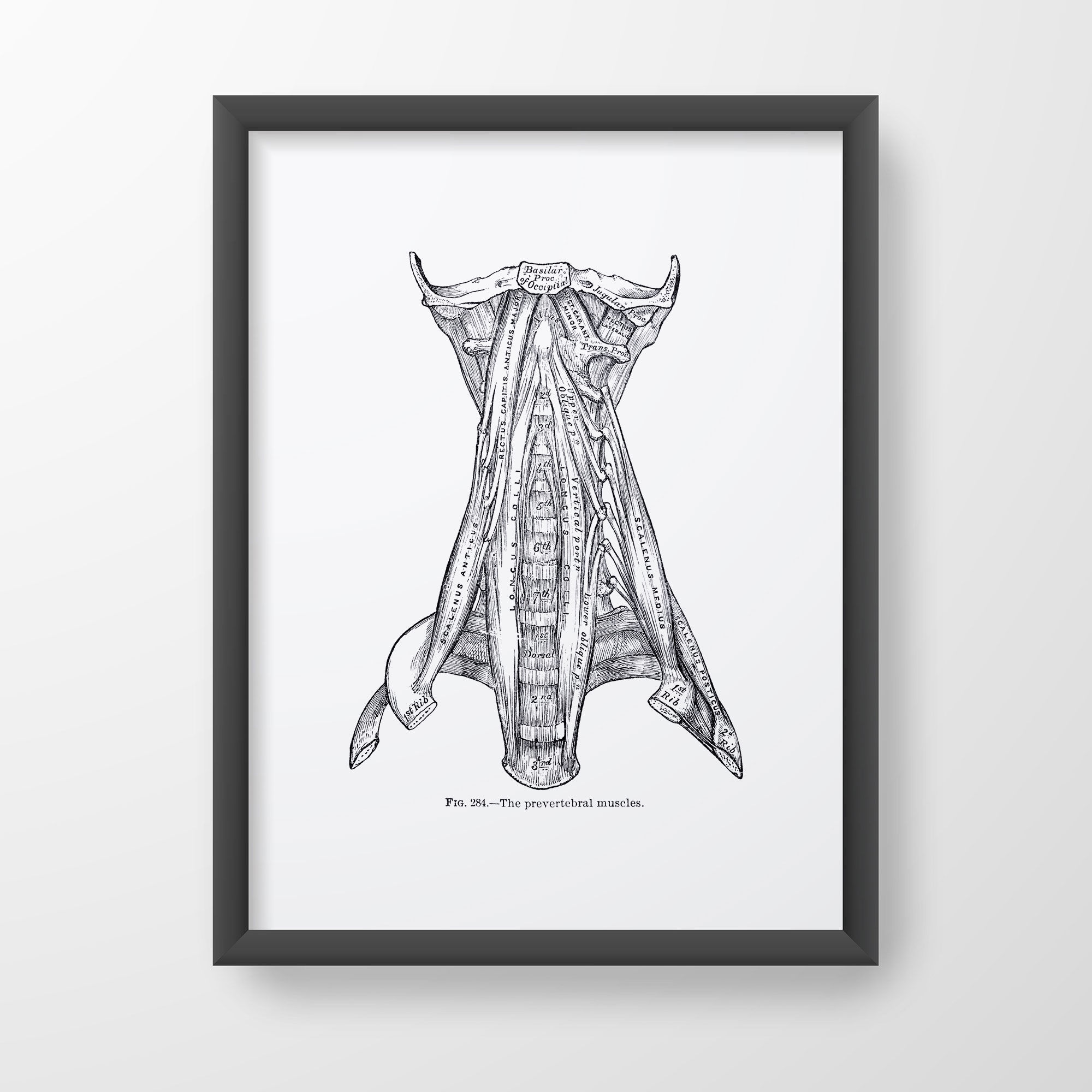 Prevertebral Neck Muscle Longus Colli Scalenus Vintage Human Anatomy Art Print