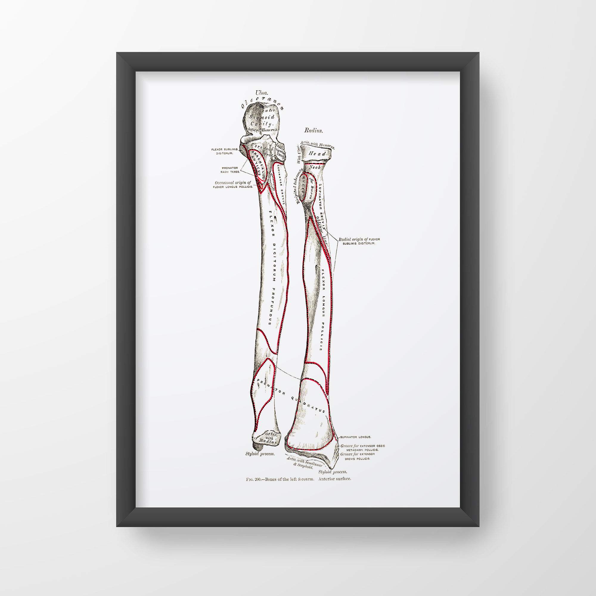 Forearm Ulna Radius Osteology Olecranon Styloid Process Human Anatomy Art Print