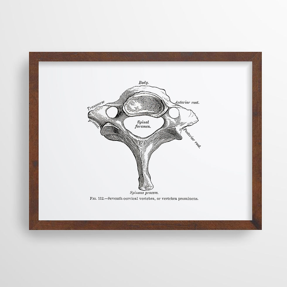 Thumbnail: Vertebra Prominens Cervical Spine Bone Vintage Osteology Human Anatomy Art Print