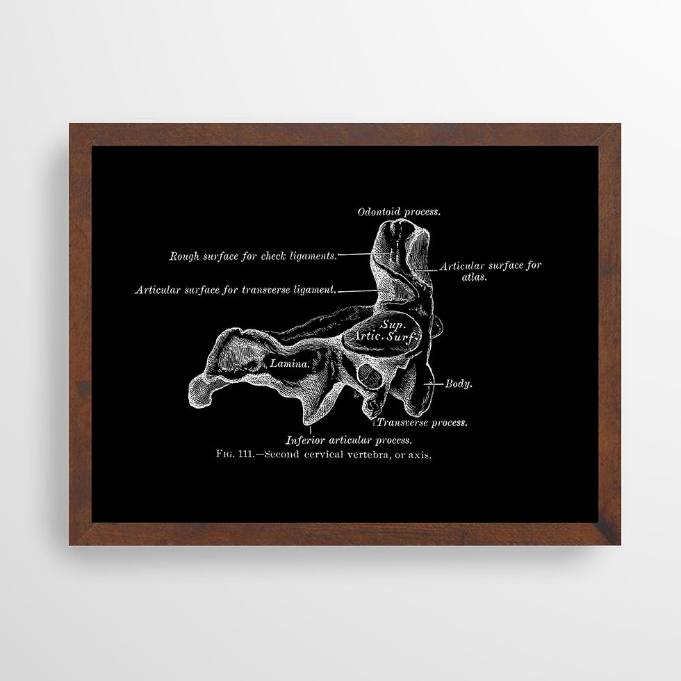 Thumbnail: Axis Cervical Vertebra Spine Vintage Bone Chiro Anatomy Art Print X-Ray Black