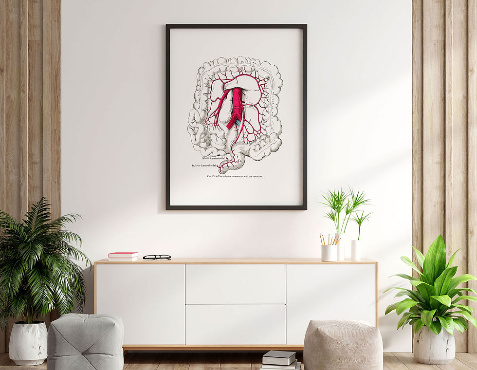 Thumbnail: Inferior Mesenteric Artery Small Intestine Transverse Colon Anatomy Art Print
