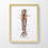 Thumbnail: Radial and Ulnar Arteries Arm Hand Muscle Human Anatomy Art Print