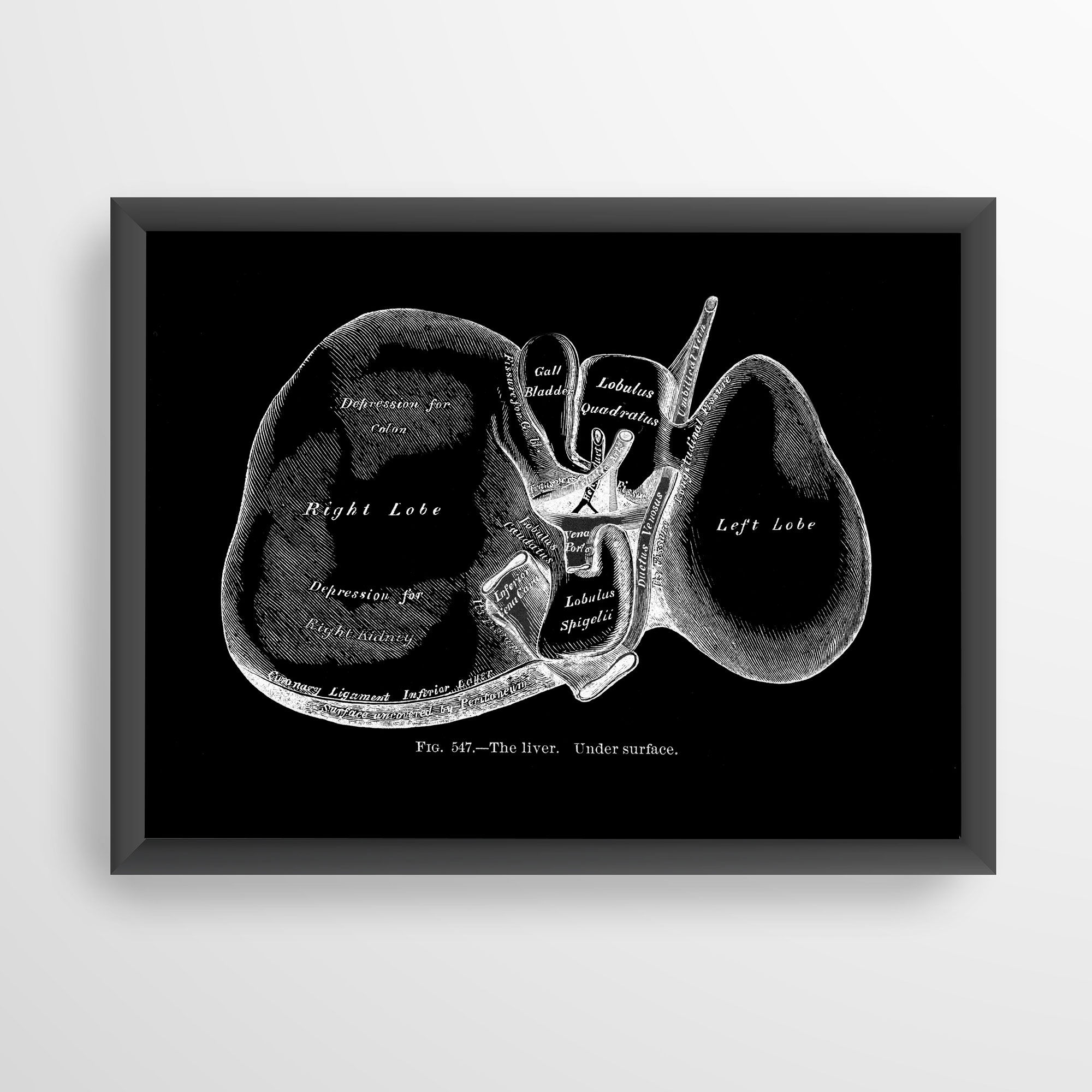 Liver Lobes Under Surface Hepatology Internal Anatomy Art Print X-Ray Black
