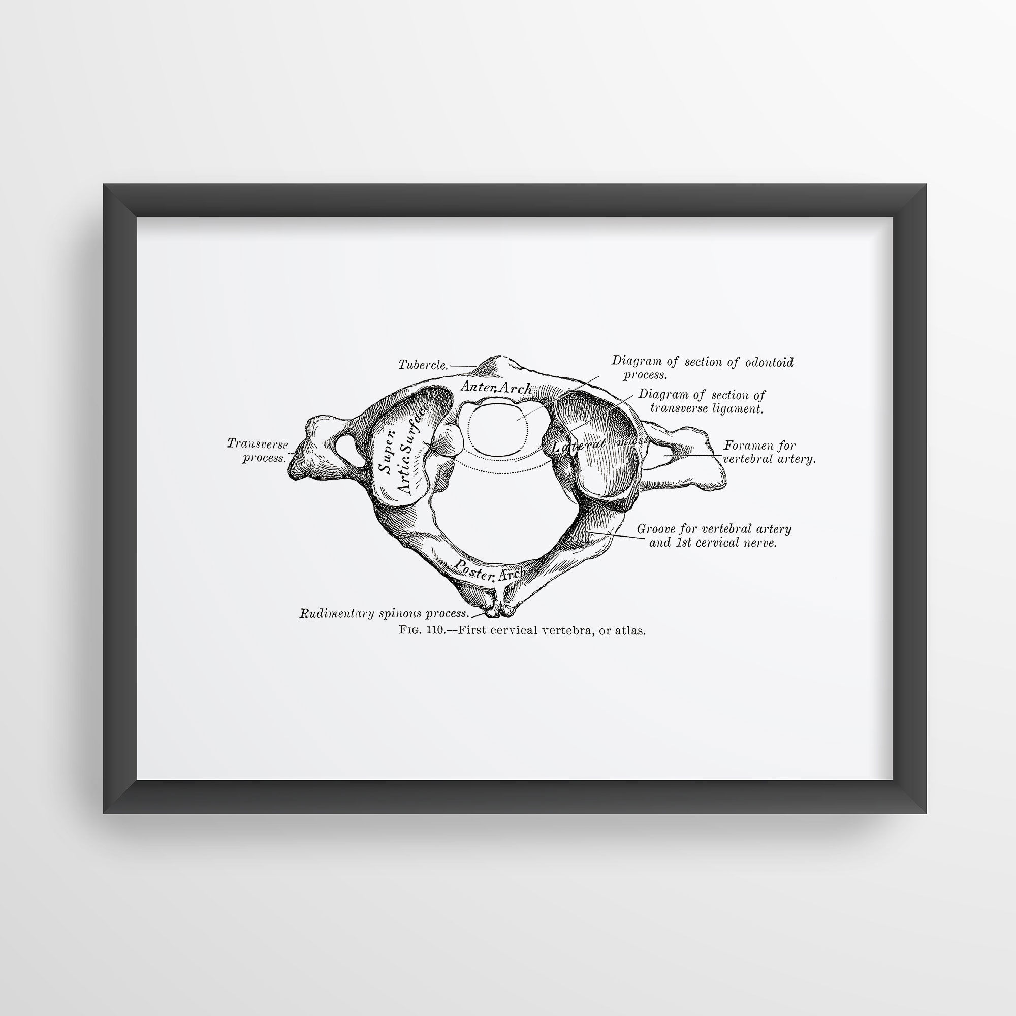 Atlas Cervical Vertebra Spine Bone Vintage Osteology Anatomy Art Print