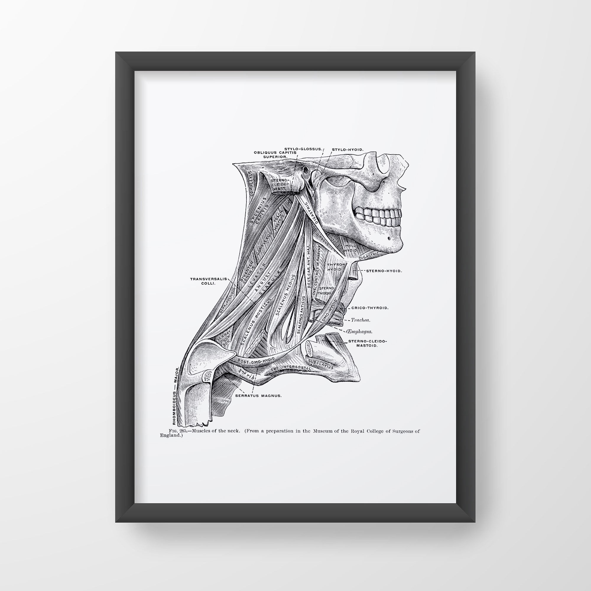 Neck Muscle Sternohyoid Sternocleidomastoid Vintage Human Anatomy Art Print