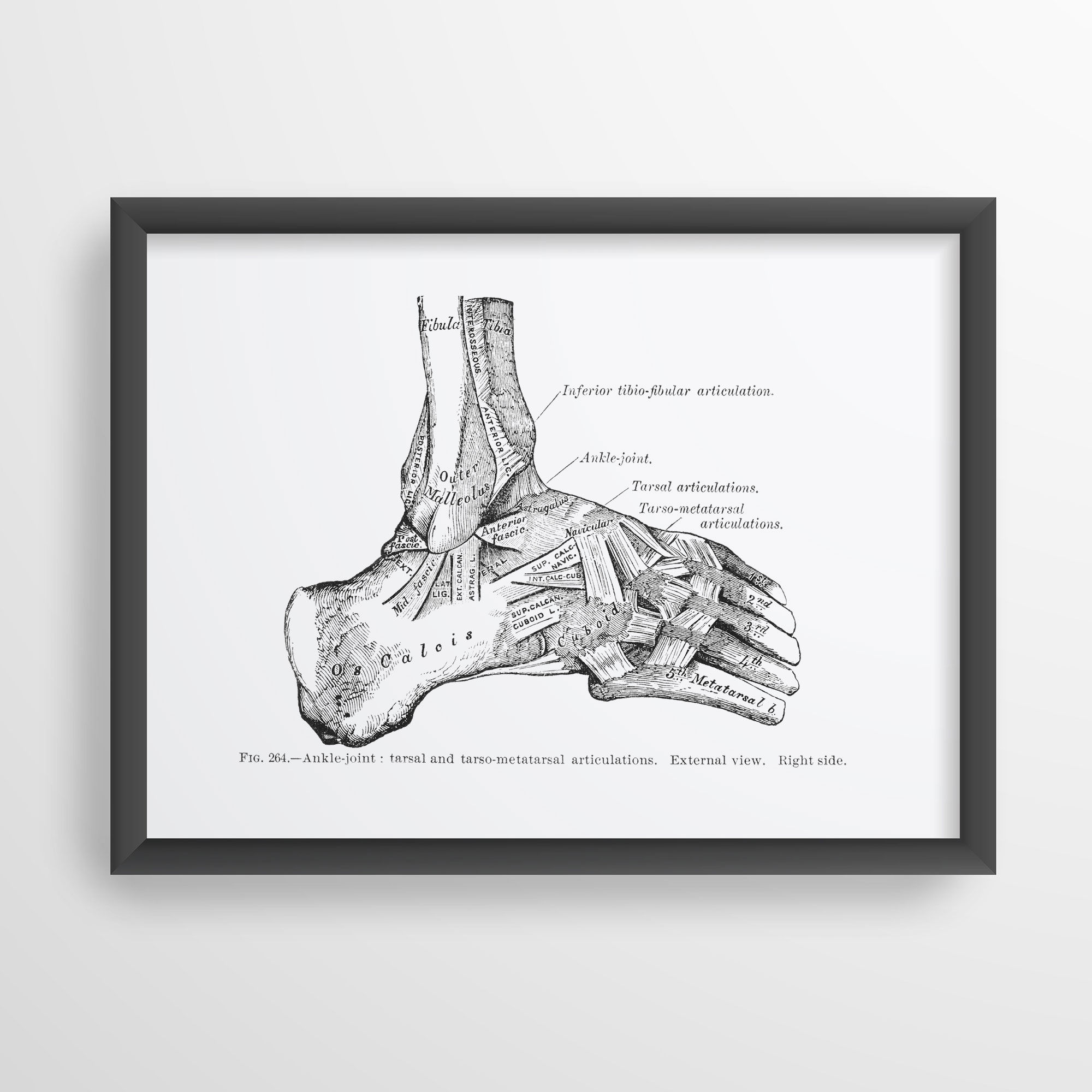 Ankle Joint Tarsal and Tarso-Metatarsal Articulation Human Anatomy Art Print