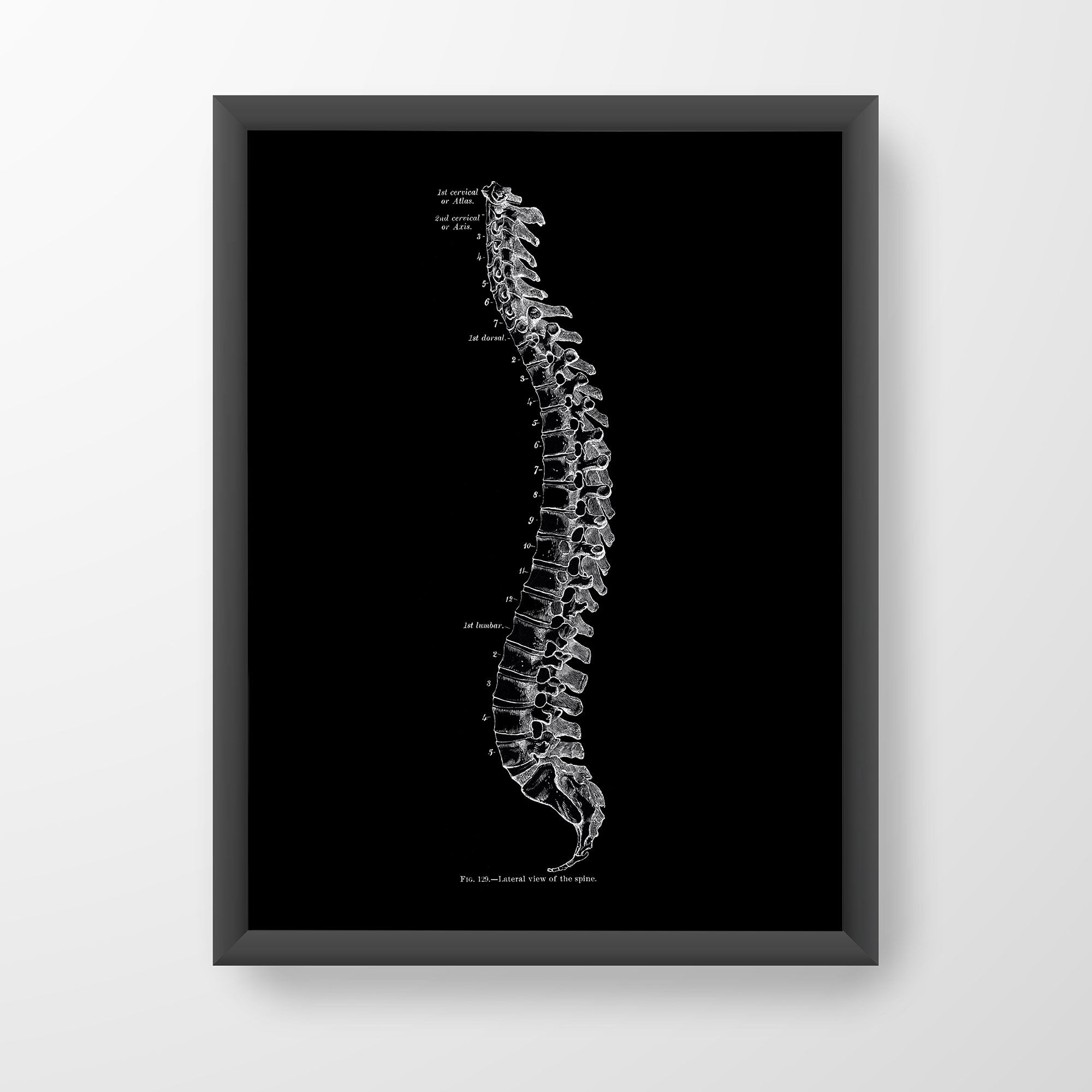 Lateral Spine Vertebrae Chiro Spinal Surgery Human Anatomy Art Print X-Ray Black
