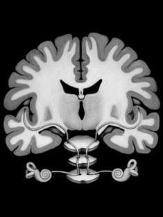 Audiology Neural Pathways painting