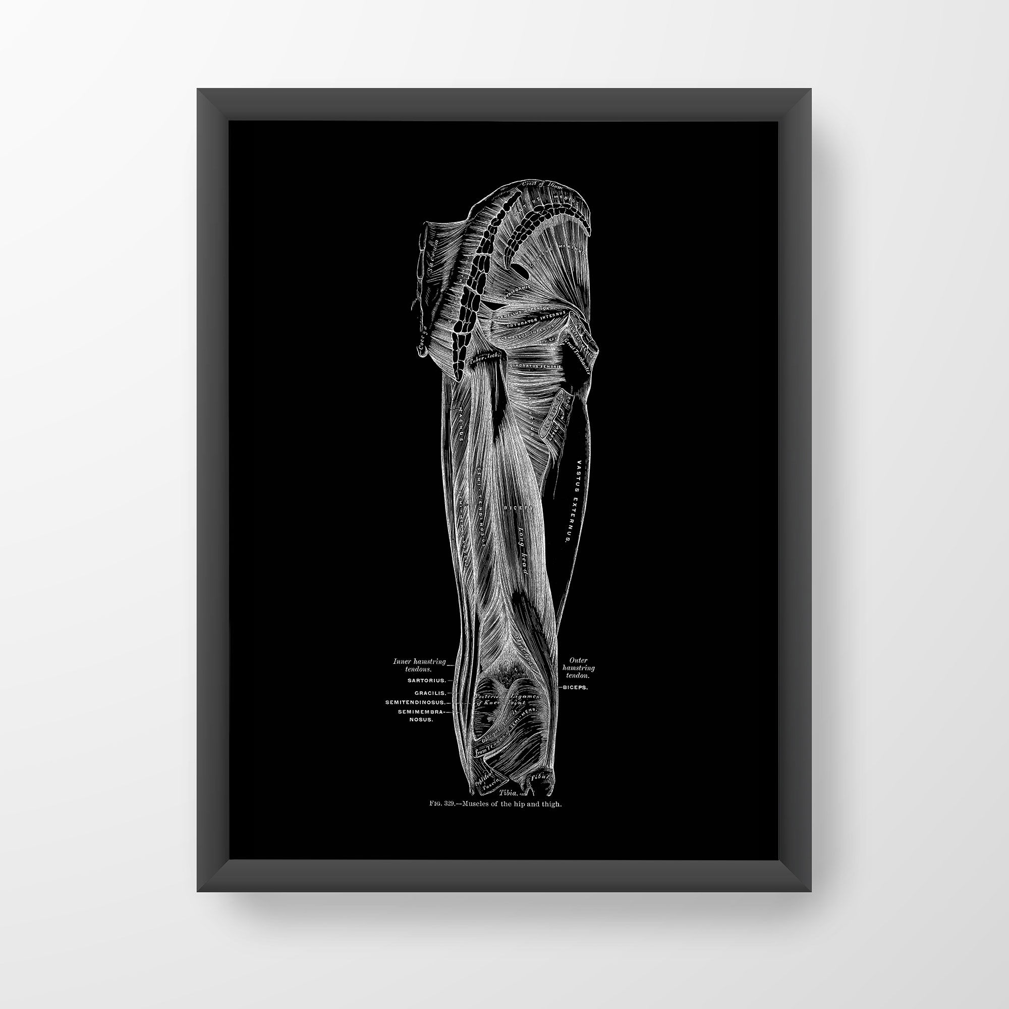 Hamstring Gluteus Human Anatomy Leg Muscle Art Print X-RayBlack