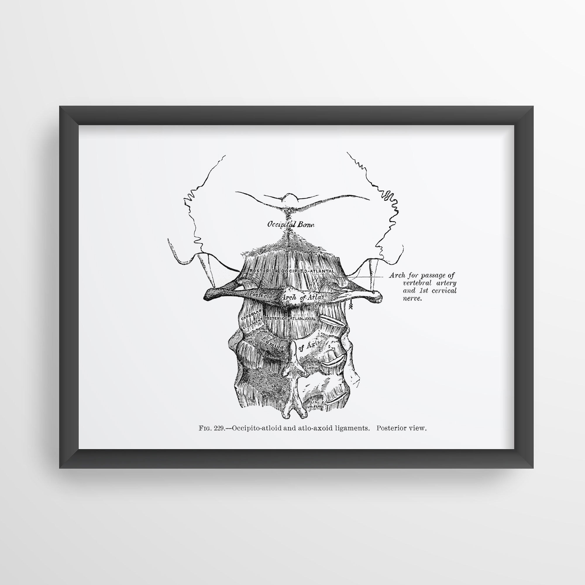 Ligaments of Cervical Vertebrae Atlas Axis Spine Vintage Human Anatomy Art Print