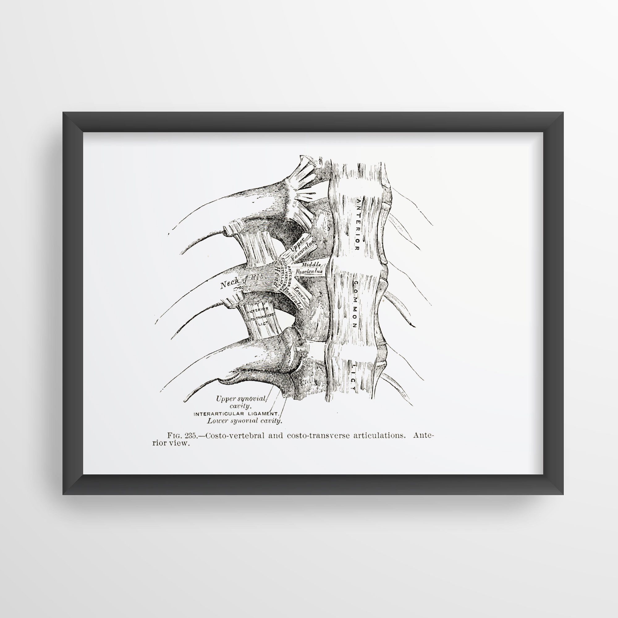 Lateral Spine Ligaments Costo-Vertebral Costo-Transverse Human Anatomy Art Print