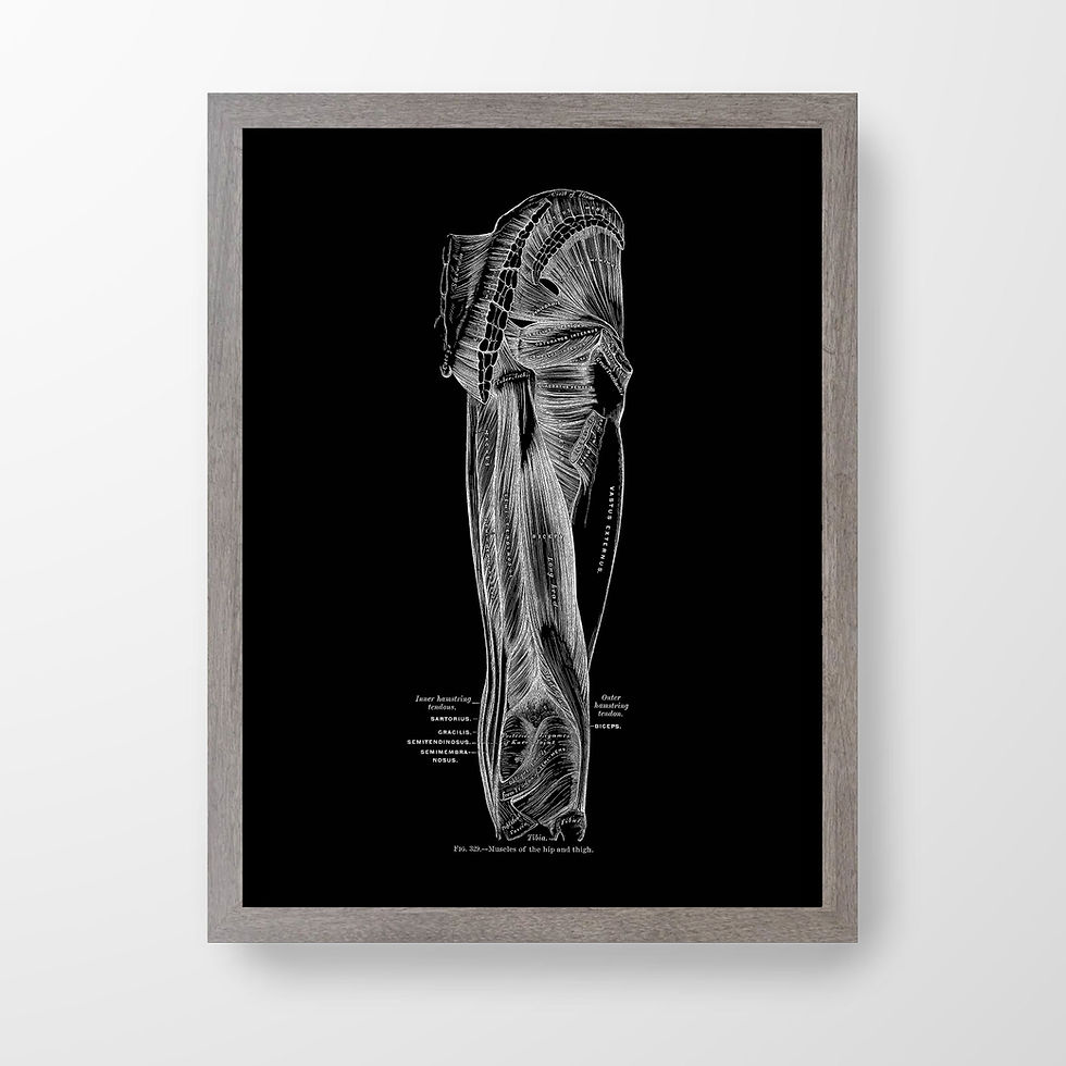 Thumbnail: Hamstring Gluteus Human Anatomy Leg Muscle Art Print X-RayBlack