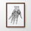 Thumbnail: Hand Flexor Muscle Ligament Tendon Vintage Human Anatomical Art Print