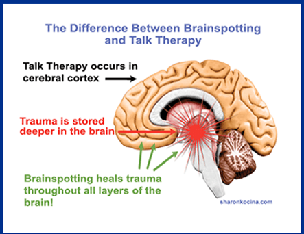 BSP Brain.png