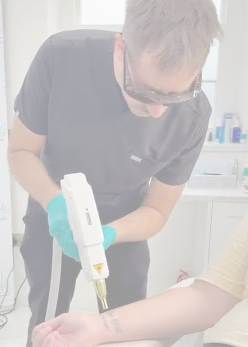laser-tattoo-removal-ink-arch-bristol-se