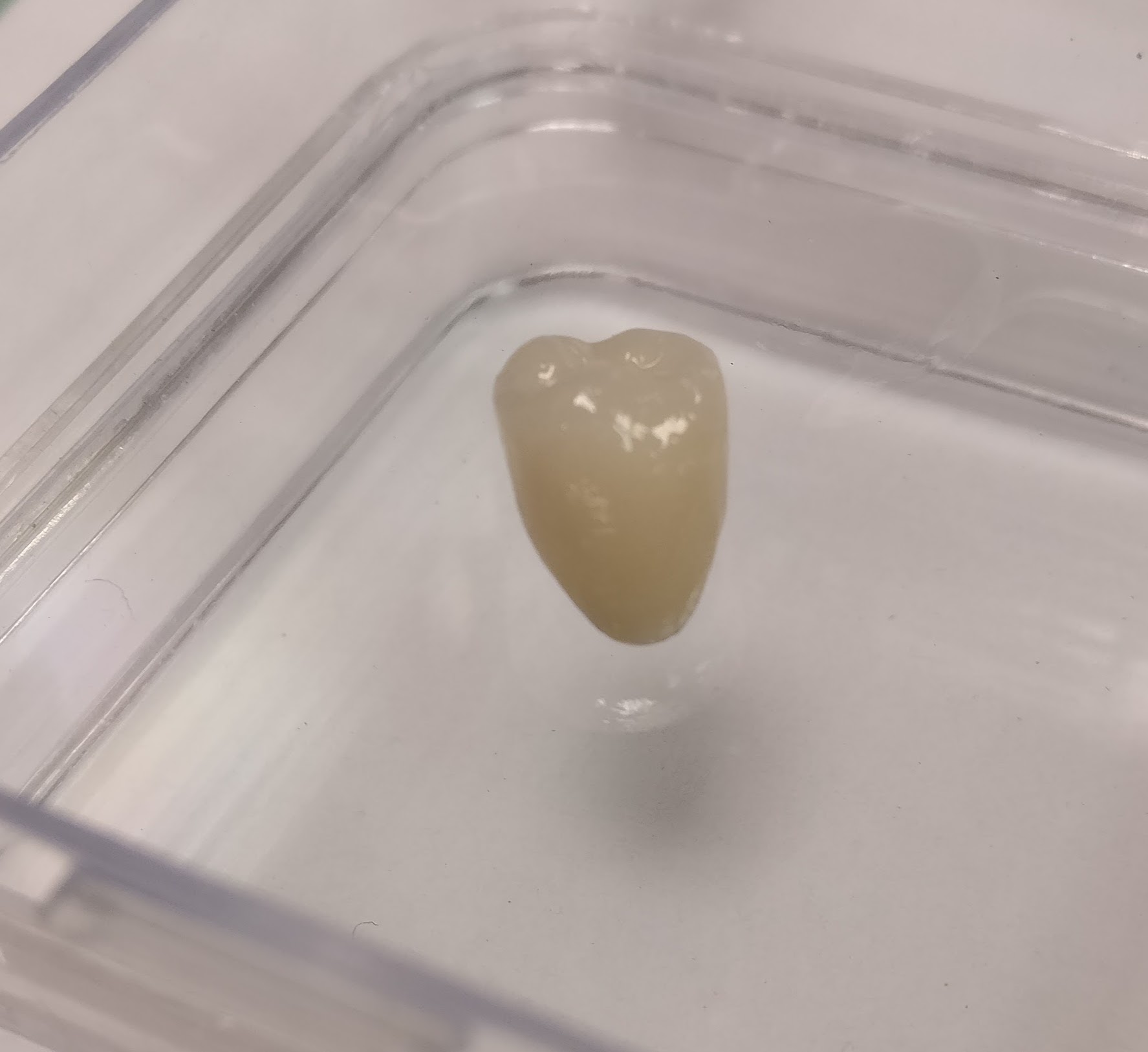 PFM crown