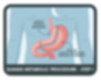 SLIMMS Metabolic Procedure - Step 1