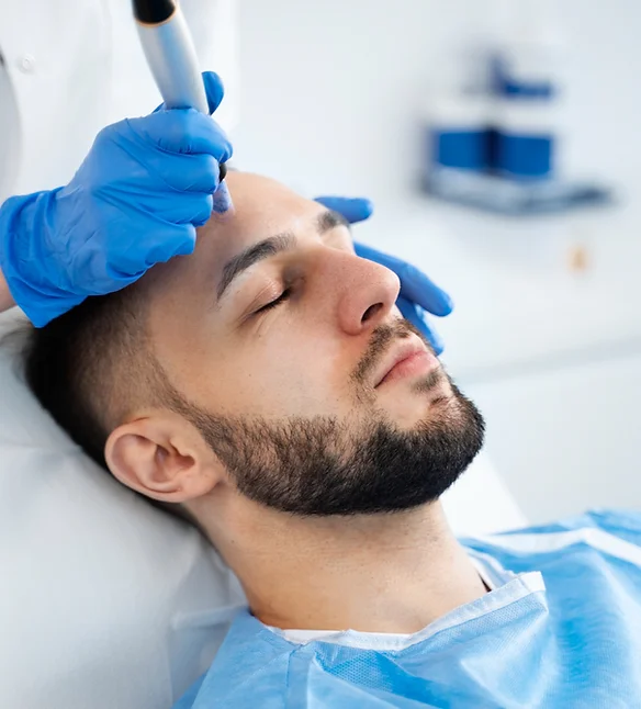 Services Microneedling.webp
